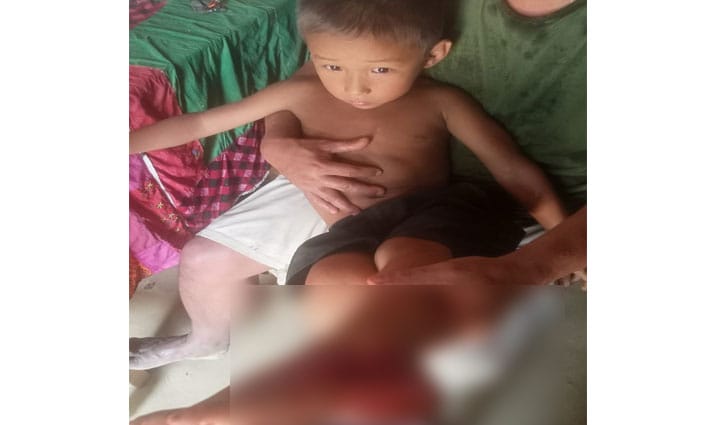 বাঘাইছড়িতে গোলাগুলি, শিশু গুলিবিদ্ধ