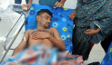 তৃতীয় বিয়ে করায় যুবকের গোপনাঙ্গ কাটলেন দ্বিতীয় স্ত্রী
