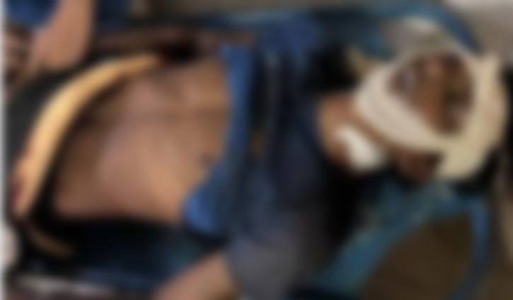 দৌলতপুরে মোটরসাইকেলে বাড়ি ফেরার পথে প্রতিপক্ষের হামলায় নিহত ১