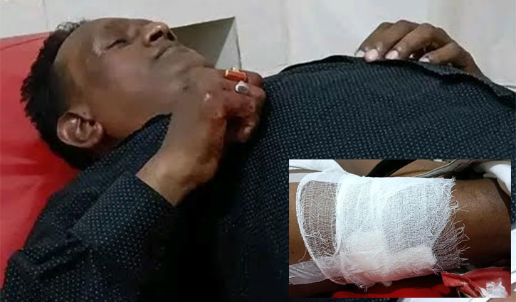কুমিল্লায় সময় টিভির সাংবাদিকের ওপর হামলা কুমিল্লায় সময় টিভির সাংবাদিকের ওপর হামলা