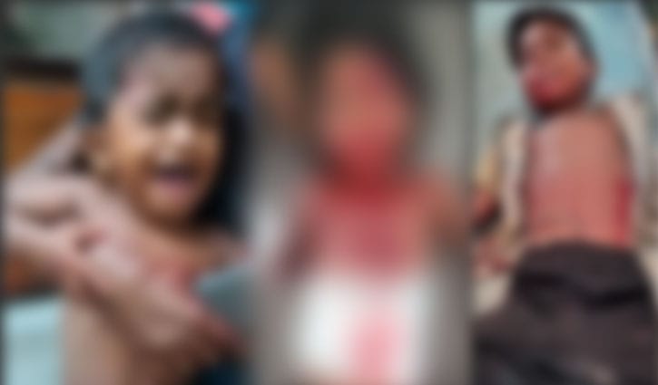যশোরে কুড়িয়ে পাওয়া ককটেল বিস্ফোরণে ৩ শিশু আহত যশোরে কুড়িয়ে পাওয়া ককটেল বিস্ফোরণে ৩ শিশু আহত