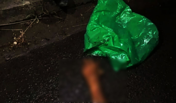 নাটোরে পলিথিনে মোড়ানো কাটা হাত উদ্ধার