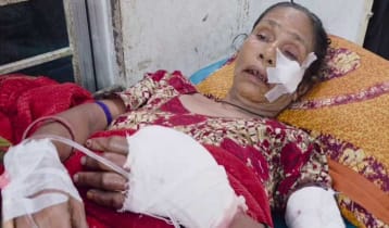 গোপালগঞ্জে ককটেল বিস্ফোরণে নারী আহত