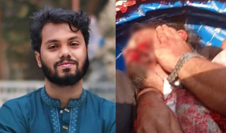 ওসমান হাদি লাইফ সাপোর্টে