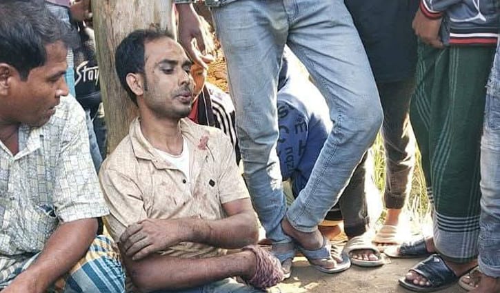 চোর সন্দেহে যুবদল নেতাকে ধাওয়া, গণপিটুনিতে ভাঙল পা