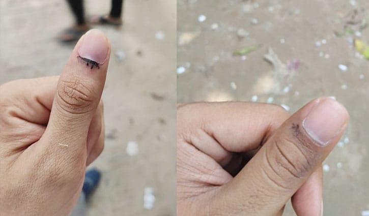 রাকসু: ‘এক ঘষাতেই’ মুছে গেছে অমোচনীয় কালির দাগ