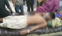 পায়ু পথে বাতাস, মৃত্যুর সঙ্গে লড়ছে শিশু শ্রমিক