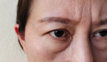 সকালে মুখ ফুলে যায় যে পাঁচ কারণে