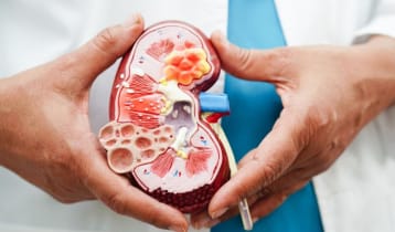 কিডনি ভালো রাখতে পাঁচটি বদভ্যাস ত্যাগ করুন