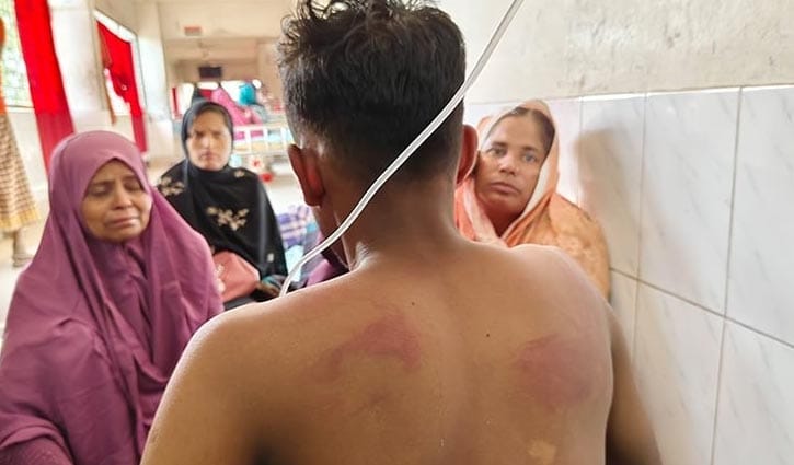 কুমারখালীতে চোর সন্দেহে ২ কিশোরকে রাতভর নির্যাতন