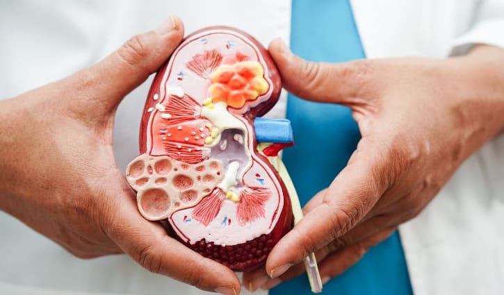 ইউরিক অ্যাসিড নিয়ন্ত্রণে করণীয়