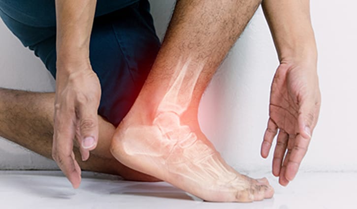 পায়ের গোড়ালিতে ব্যথা হলে যা করতে পারেন