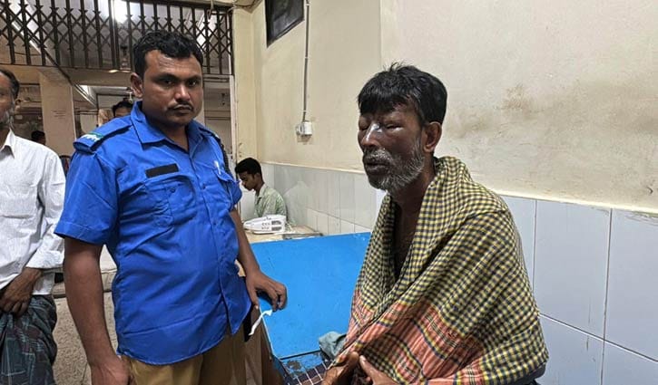 উচ্চস্বরে কথা বলায় ঘুমন্ত স্বামীকে এসিডে ঝলসে দিলেন স্ত্রী