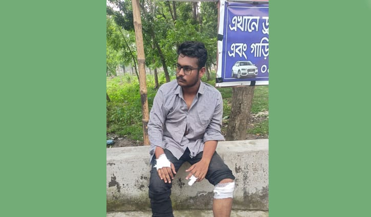 বাকৃবিতে মতাদর্শের দ্বন্দ্বে মারধরের অভিযোগ