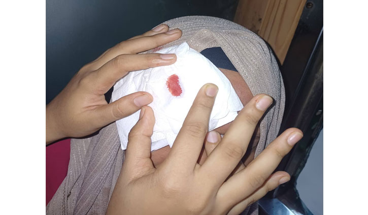 চবি শাটলে পাথর নিক্ষেপ, আহত শিক্ষার্থী
