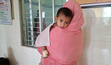 সিরাজগঞ্জে হামের উপসর্গে আক্রান্ত ১৬ রোগী হাসপাতালে ভর্তি