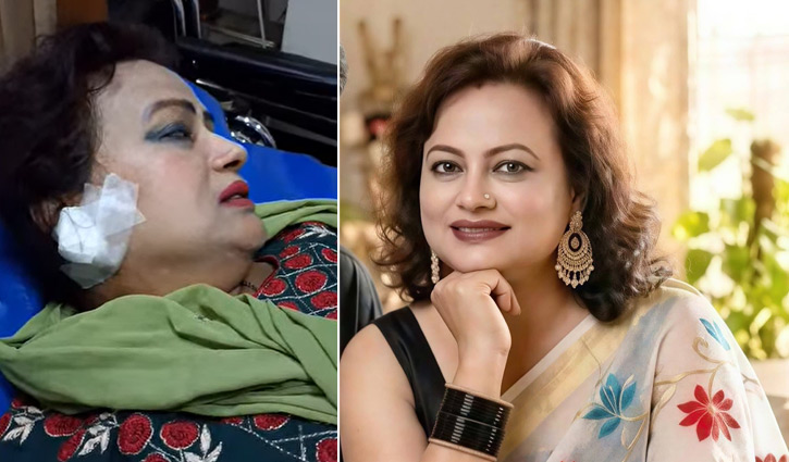 ছিনতাইকারীর টানে কান ছিঁড়ল নায়িকার