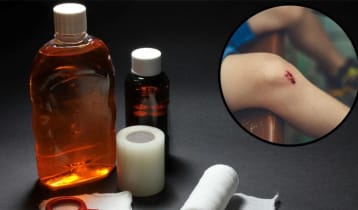 মেয়াদোত্তীর্ণ ‘অ্যান্টিসেপটিক’ ব্যবহার কতটা নিরাপদ?