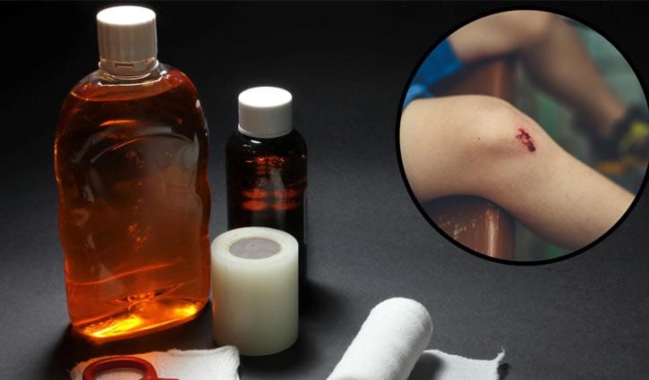 মেয়াদোত্তীর্ণ ‘অ্যান্টিসেপটিক’ ব্যবহার কতটা নিরাপদ?