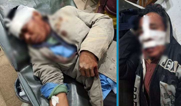 আলীকদমে ফসল চুরিকে কেন্দ্র করে হামলা, আহত ১৮