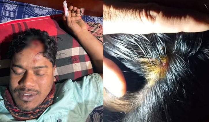 হাতিয়ায় বিএনপি-এনসিপি সংঘর্ষ, আহত ৯