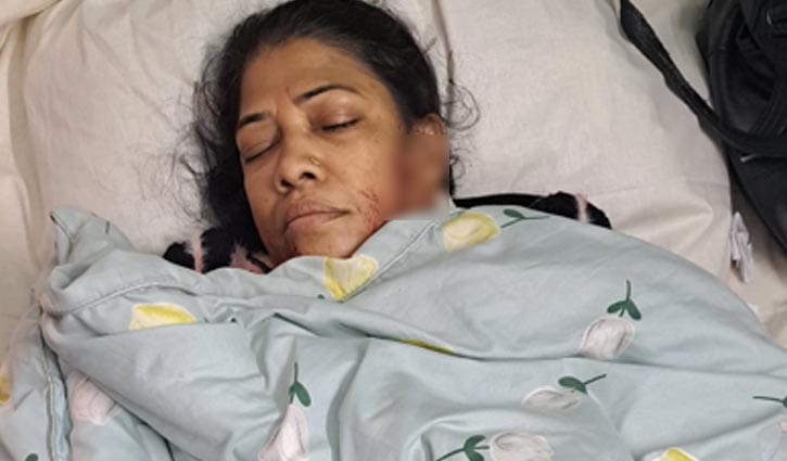 হাসপাতালে ঢুকে সাবেক স্ত্রীকে কোপালেন আমিরুল