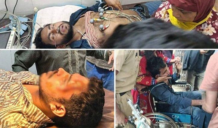 জবিতে ফুটবল খেলা নিয়ে সংঘর্ষে শিক্ষক-সাংবাদিকসহ আহত ৩০