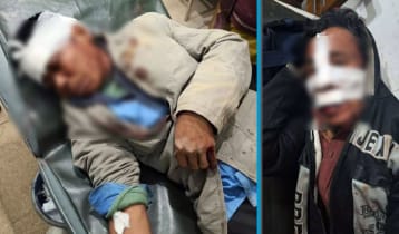 আলীকদমে ফসল চুরিকে কেন্দ্র করে হামলা, আহত ১৮