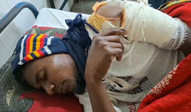 ফরিদপুরে জামায়াতকর্মীকে ছুরিকাঘাত-হাতুড়িপেটার অভিযোগ