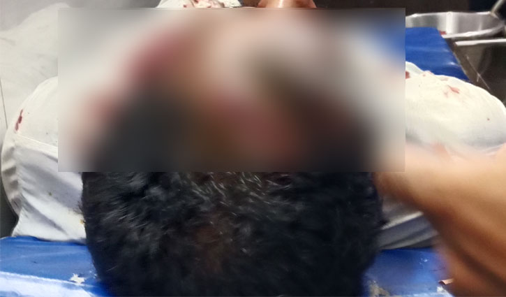 ইবিতে মারামারিতে আহত ভ্যানচালক