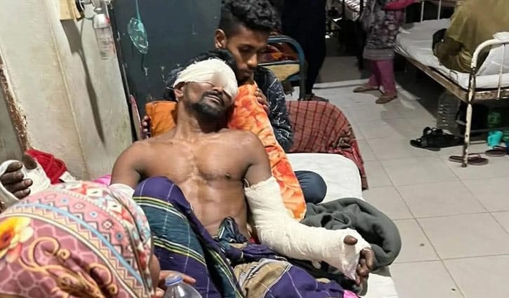 বাগেরহাটে মাছ চুরির অভিযোগে অমানবিক নির্যাতন