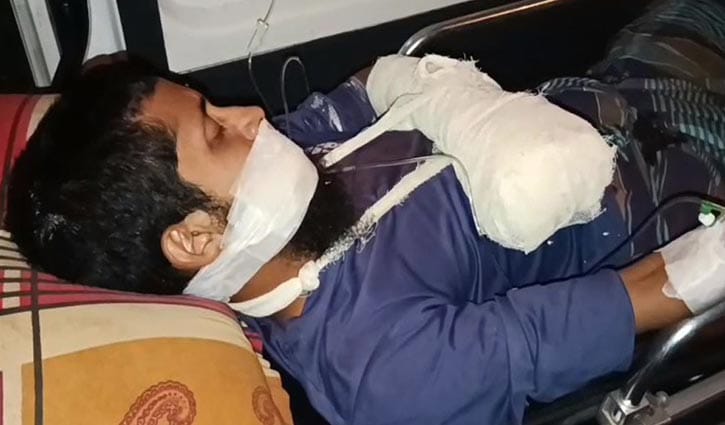 গোপালগঞ্জে ‘বোমা’ বানানোর সময় বিস্ফোরণ, ছাত্র আহত