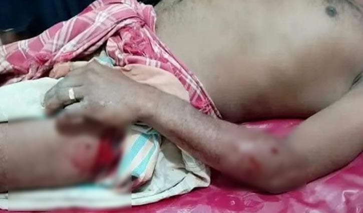 কুষ্টিয়ায় শরীরে পেরেক ঢুকিয়ে মধ্যযুগীয় কায়দায় নির্যাতনের অভিযোগ