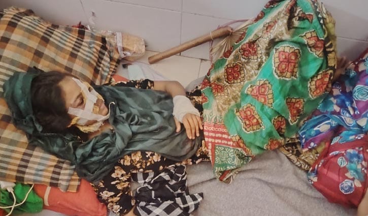 ‘ব্লেড’ দিয়ে খুঁচিয়ে সাবেক স্ত্রীকে হত্যাচেষ্টার অভিযোগ