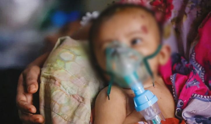 টিকা ব্যবস্থাপনায় গাফিলতি, পুষ্টিহীনতায় বাড়ছে হামে মৃত্যু