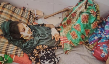 ‘ব্লেড’ দিয়ে খুঁচিয়ে সাবেক স্ত্রীকে হত্যাচেষ্টার অভিযোগ