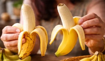 কৃত্রিমভাবে পাকানো কলা: কীভাবে চিনবেন ও কেন সতর্ক থাকবেন