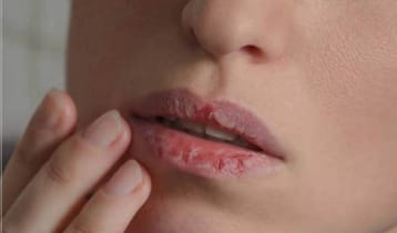 সকালে ঠোঁট-মুখ শুকিয়ে যায়? করণীয় জেনে নিন