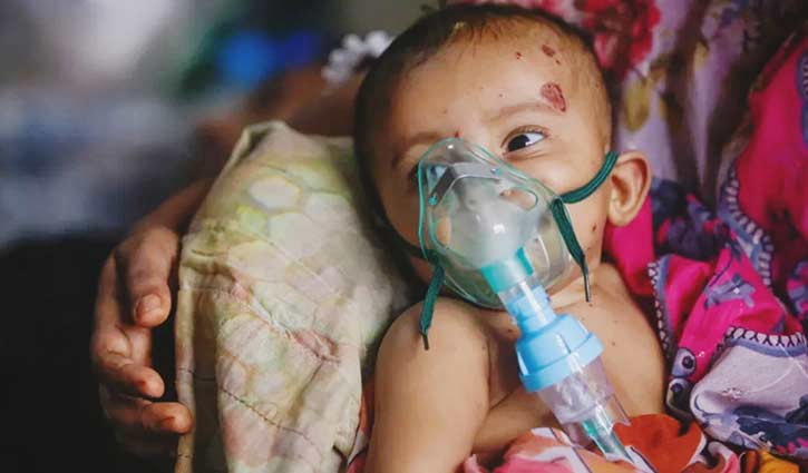 হামের সঙ্গে নিউমোনিয়ায় আক্রান্ত শিশুদের অবস্থা জটিল হচ্ছে