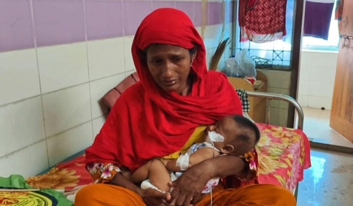 হামের লক্ষণ নিয়ে মমেকে আরো ২৬ শিশু ভর্তি